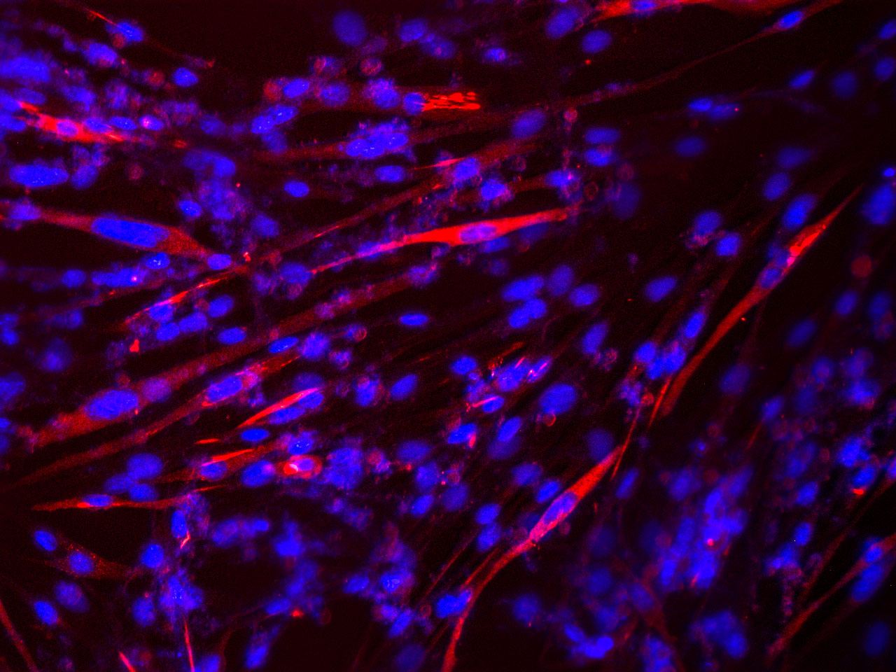 Imagen microscópica de la formación de fibras musculares in vitro a partir de células madre de músculo de ratón.