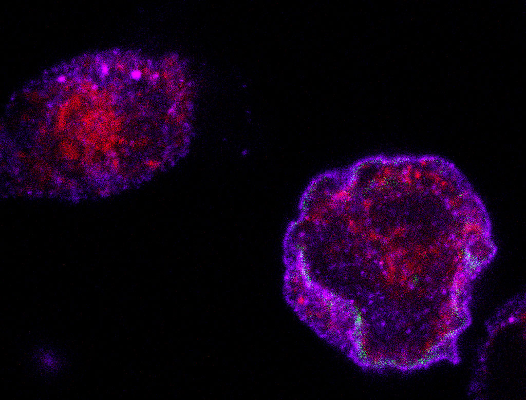 Imagen microscópica células musculares en cultivo normales (izquierda) y con Vav2 hiperactivado (derecha) mostrando en azul la cantidad de proteína de captación de glucosa presente en la membrana.