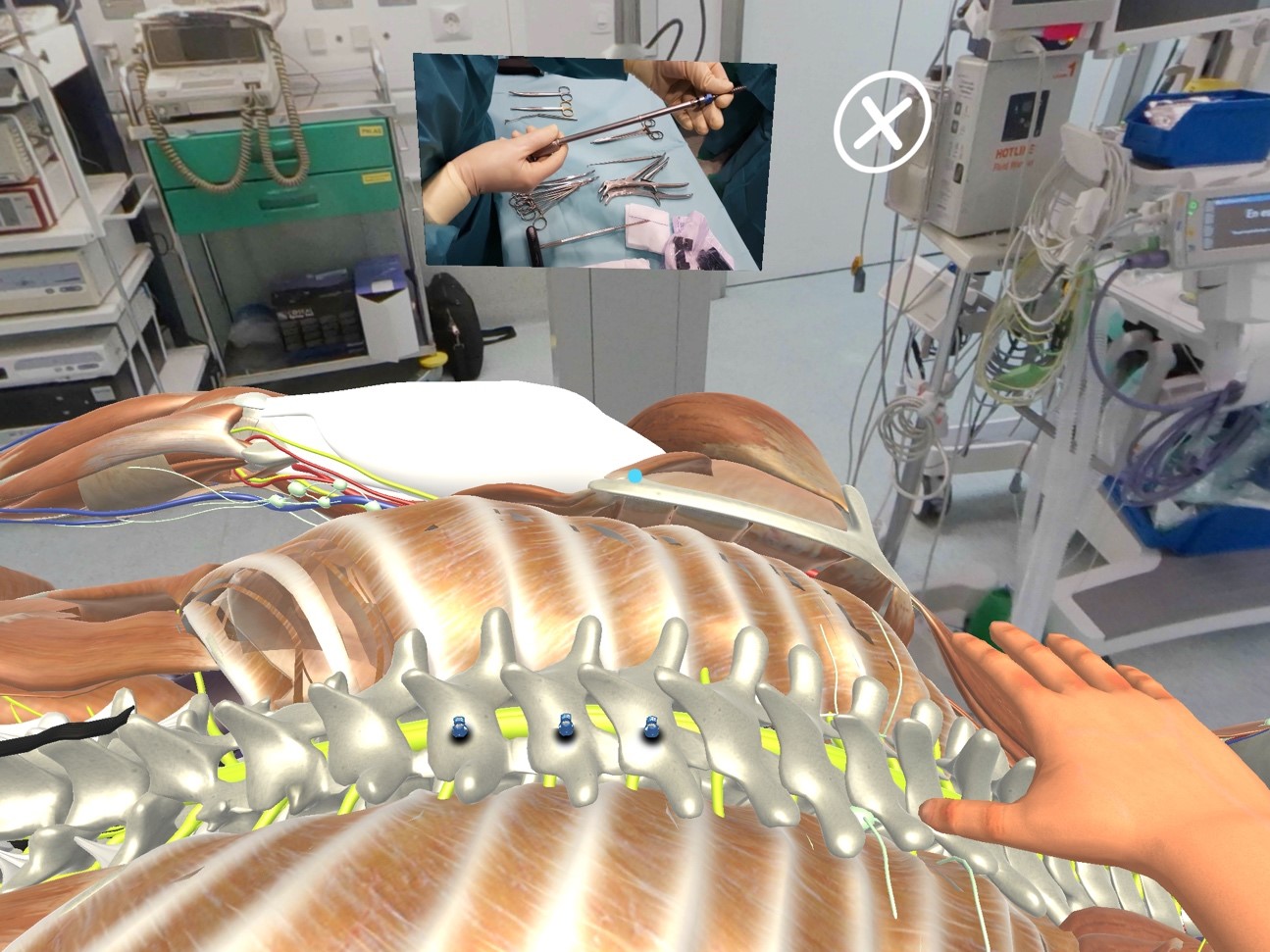 La Universidad de Salamanca desarrolla el primer simulador virtual de intervención quirúrgica en columna vertebral para una escoliosis