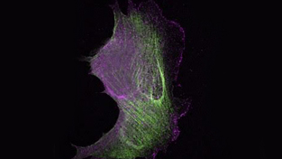 Científicos del Centro de Investigación del Cáncer publican en la revista Current Biology nuevos avances sobre los mecanismos que permiten a las células controlar su textura