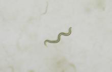 La Universidad de Salamanca demuestra el potencial de los bioinoculantes bacterianos para contrarrestar el daño celular asociado al envejecimiento