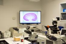 La USAL adquiere un Microscopio Láser Microdisector para el Centro de Investigación del Cáncer